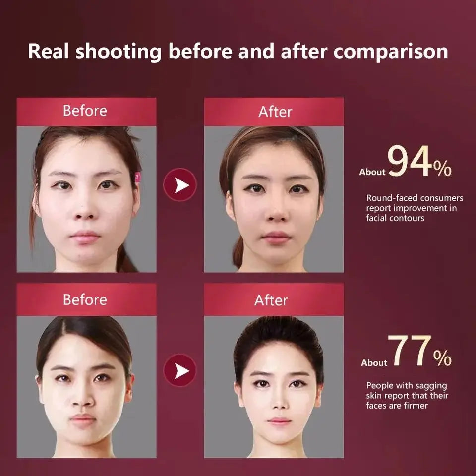 Facial Lifting Massager 12 Gears Electric Facial Massager
